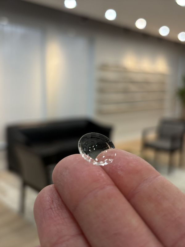 Dry Eye Treatments 6 Custom Scleral Lens At 1-800-Dry-Eyes Specialty Office In Southfield, Michigan